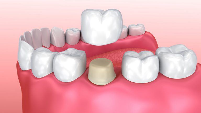 "Dental
