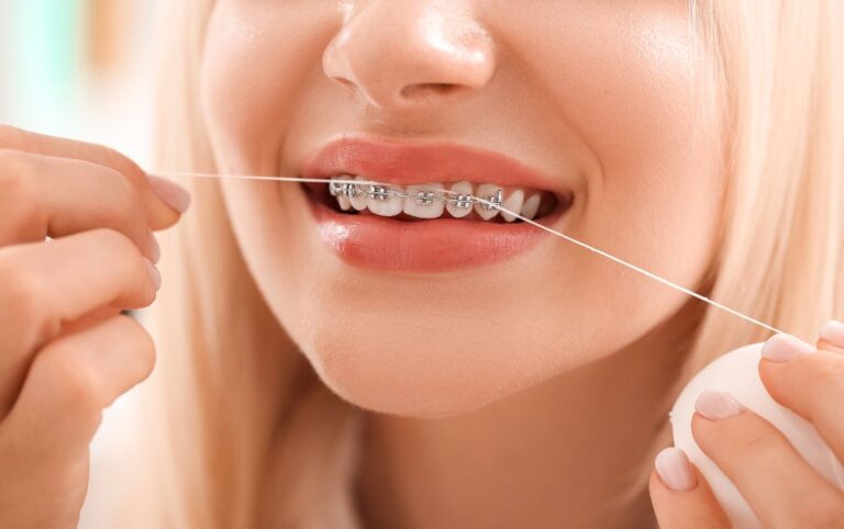 "Braces