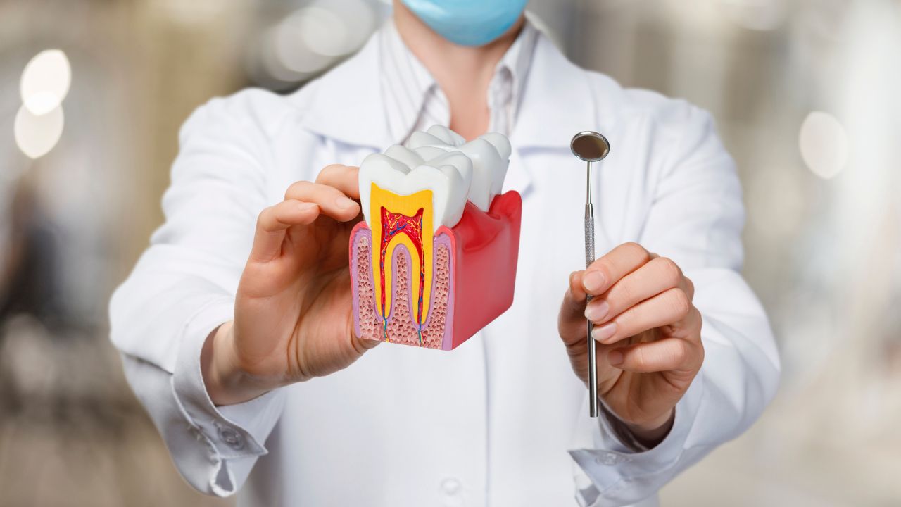 Signs You Might Need a Root Canal