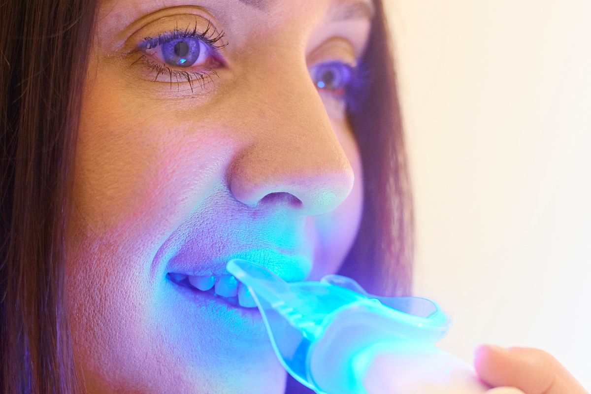 What to Eat After Teeth Whitening Treatment?