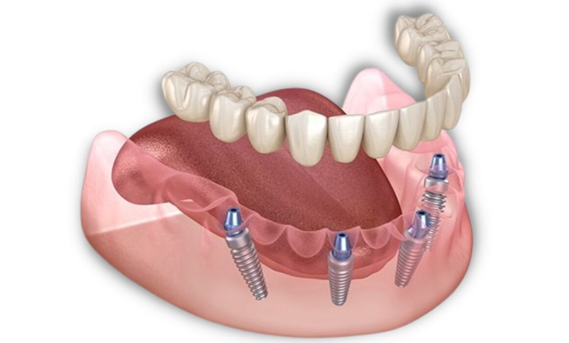 "Dental