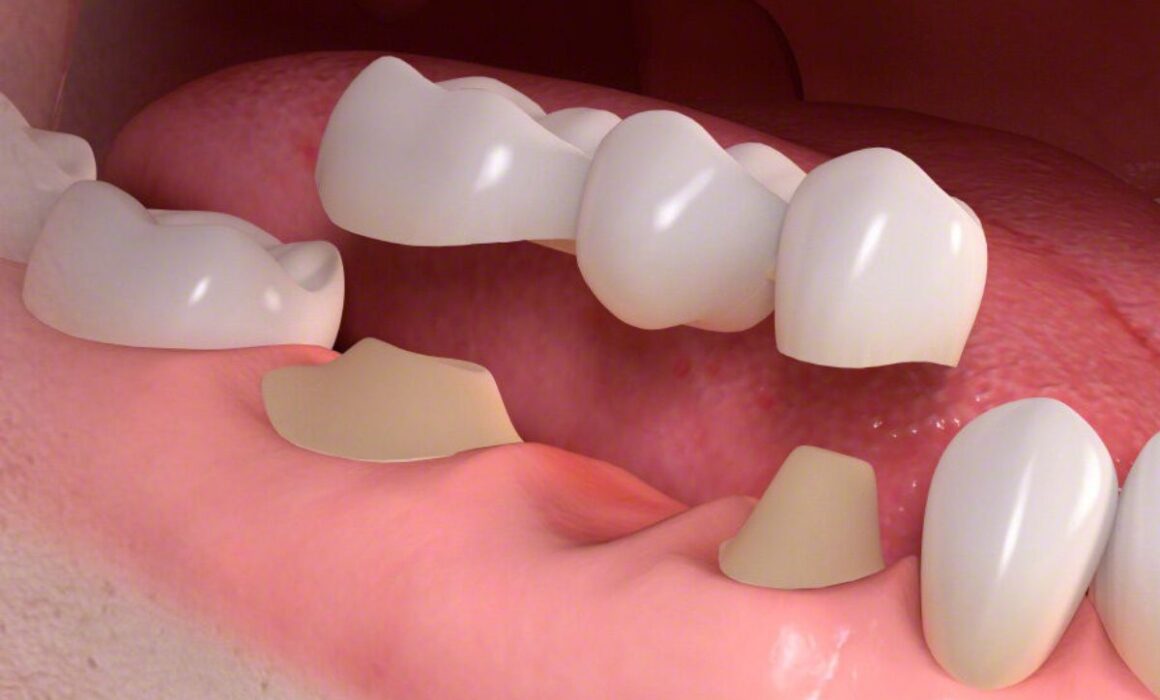 "Dental