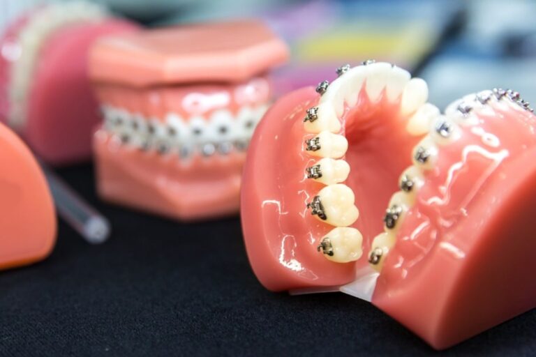 "Orthodontics