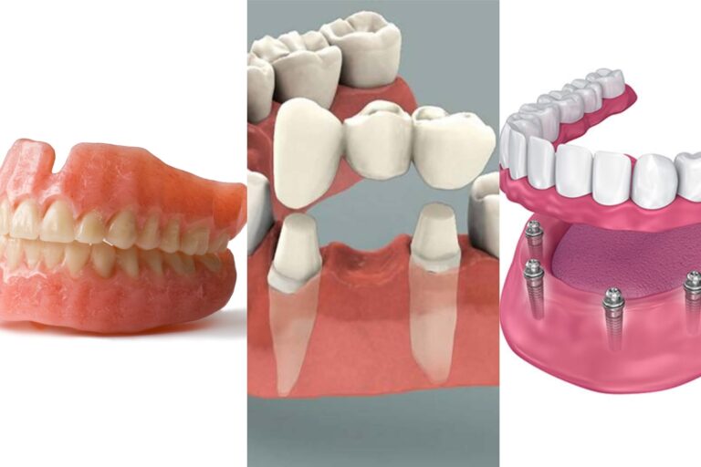 "Dental