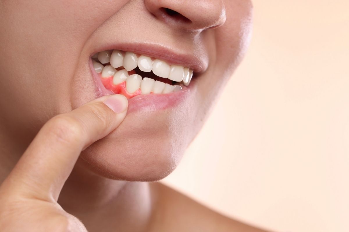 Preventing Gum Disease: Daily Habits That Protect Your Smile
