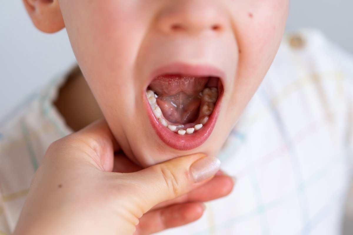What to Do If Your Child’s Tooth Grows Abnormally