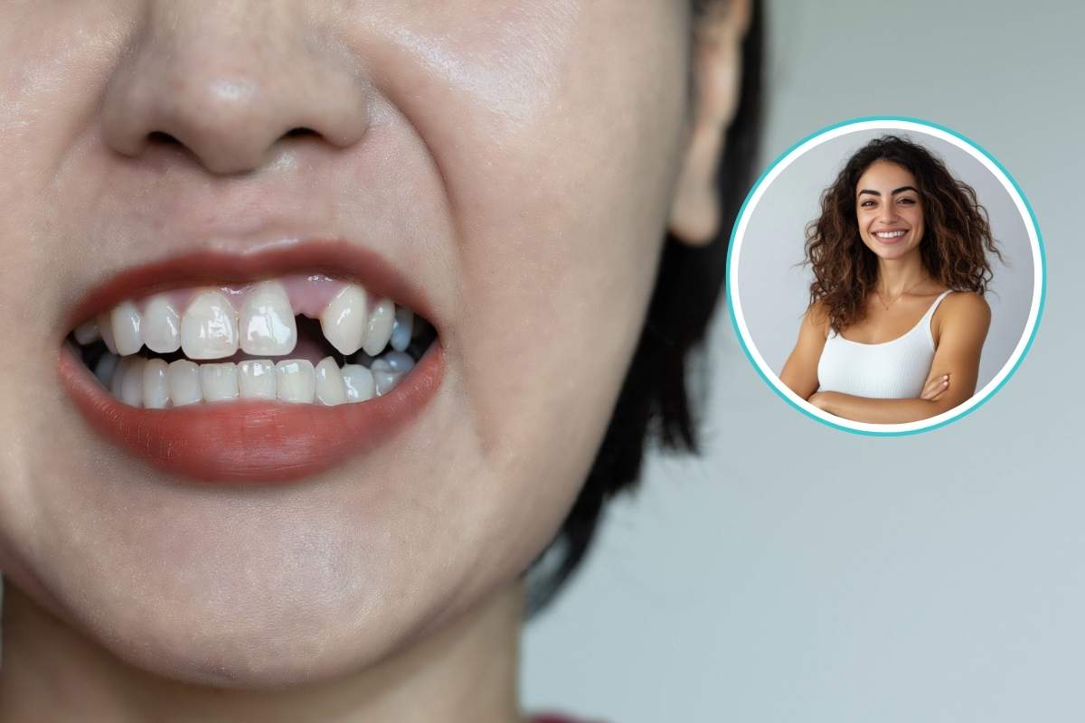 5 Best Long-Term Tooth Replacement Options for a Healthy, Confident Smile